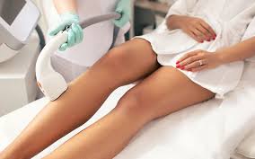 Laser hair removal is a noninvasive treatment in which concentrated beams of laser light target the if you've really decided to ditch the razor for good, you may be wondering: How Permanent Is Laser Hair Removal Avance Clinic