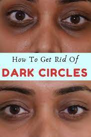 Check spelling or type a new query. How To Get Rid Of Dark Circles And Wrinkles Skin Care Face Mask Dark Circles Best Skin Care Routine