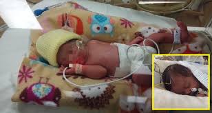 By jamie solomon, director of baby signs malaysia and certified instrutor of the baby signs(r) program article in hello, from all of us at baby signs malaysia! Malaysian Lady Delivers Premature Baby In Uk Now Needs Rm500 000 To Pay Bill World Of Buzz