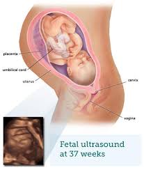 Fetal Ultrasound 8 Months Babycentre Uk