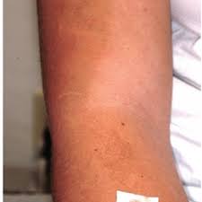 Apply once a week to the neck to help get rid of the appearance of neck lines. Soap And Water Will Not Clean Dirty Skin Clinician Reviews