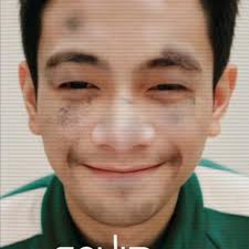 Neil Wayne Salces (@champ_waynemd) • Instagram photos and videos