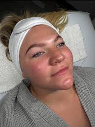 We're thrilled to welcome our new cosmetic injector, Kayla Collum, DNP,  FNP-C, to our team! Kayla graduated from the University of Mississippi  Medical Center in 2019 with her Bachelor of Science in