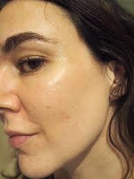 Personally, i use this serum after cleansing/toning and before applying your moisturizer. The Ordinary Results Before And After Pictures