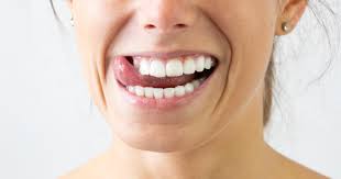 Putzen sie mindestens zwei mal täglich ihre zähne und achten sie auf die korrekte zahnputztechnik. Weisse Zahne Hausmittel 9 Naturlichen Zahnaufheller We Go Wild