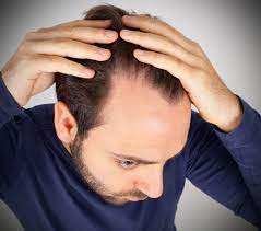 mevsimsel sac dokulmesi hairneva