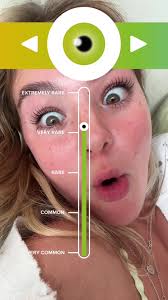 I Do Not Care How Rare My Eye Color Is