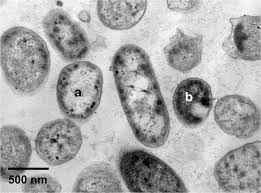 Image result for Cremaspora triflora