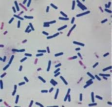 Listeria monocytogenes or just l. Gram Staining Rules