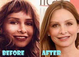 Calista Flockhart Plastic Surgery Before And After Pictures Christina Aguilera Plastic Surgery Plastic Surgery Plastic Surgery Facts