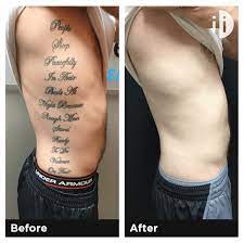 It does not cost a lot like the other procedures which are usually very costly and is charged on the basis of each appointment which not a lot of people can afford. 7 Factors That Determine The Cost Of Your Tattoo Removal Tattoo Cares