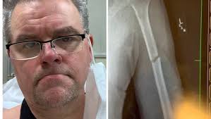 Fundraiser by Regie Hamm : Regie's busted arm fund