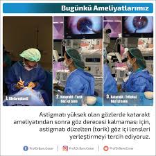 Astigmati Yuksek Olan Gozlerde Katarakt Ameliyatindan Sonra Goz Derecesi Kalmamasi Icin Astigmati Duzelten Torik Goz Ici Lensleri Yerlestir Tintin Ordu Ikiz