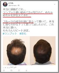 うそっ 長年悩んだ薄毛がこんなフサフサになるなんて 頭にフルーツを塗る 毛生え薬 を2ヶ月試した結果がスゴすぎる trend beauty 薄毛 体 健康