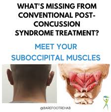 Image result for Postconcussion Syndrome