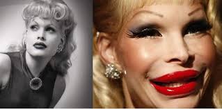 TOP 10 Galeria de Horrores de celebridades vítimas de cirurgias plásticas  desastrosas Geral!