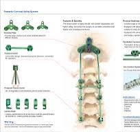 Posterior Occipitocervical Spine Screw System,Medical Device ...