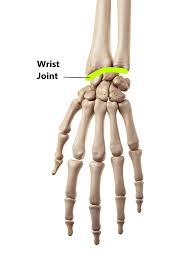 Image result for TFCC Steroid Injection