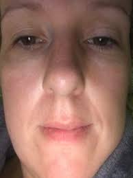 6 weeks old and fully organic, no staple drugs.