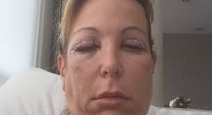 Steve Samuel, MD, Certified Plastic Surgeon