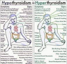 Hypothyroidism Vs Hyperthyroidism Hyperthyroidism Symptoms Hyperthyroidism Hypothyroidism Exercise