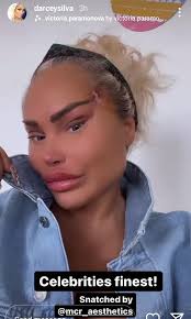 TLC accountable for body dysmorphia issues