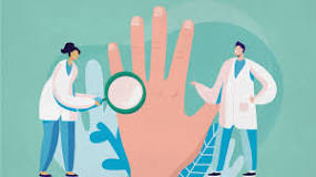 Image result for dupuytren's contracture what to expect during treatment