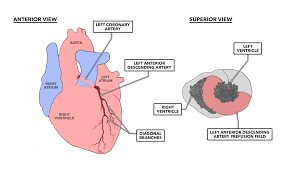 Diagonal branches of the left anterior descending artery. Crossfit The Heart Part 7 Coronary Circulation