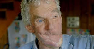 Bear attack victim who had face ripped off: 'I dug debris out of my airway' 