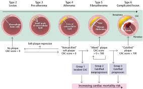 Coronary Artery Calcium Scoring Its Practicality And