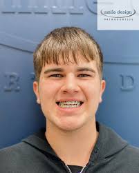 Congratulations to Tucker for getting his braces!! 😁 · Call our office to  schedule your FREE consultation today!! 337-405-0371 📲 -or- Visit our  website and request a FREE consultation! www.smiledesignorthodontics.com  🖥️ #mossbluffbraces #