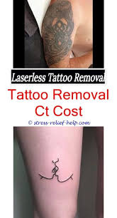 Laserless tattoo removal helps in removing that dreadful tattoo that you want removed from your body quire easily. How Popular Is Tattoo Removal Does Removing Tattoos With Salt Work What Does Removing A Tattoo Feel Lik Tattoo Removal Cost Tattoo Removal Cream Tattoo Removal