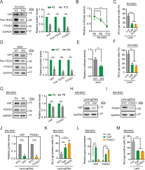 Null discover exclusive deals and reviews of aminyap online! Up Regulation Of Foxd1 By Yap Alleviates Senescence And Osteoarthritis