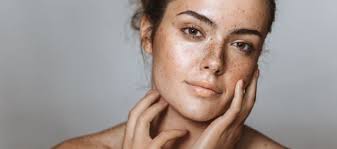 Ins and Outs of Skin Discoloration