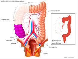 Maybe you would like to learn more about one of these? Colon Traitement Du Cancer Cancerologie Chirurgie Viscerale Et Digestive Chirurgie Du Beaujolais