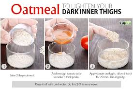 How To Lighten Your Dark Inner Thighs Naturally Top 10 Home Remedies Dark Spots Remedies Skin Cleanser Products Thighs