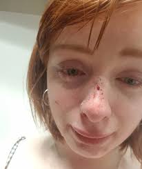 Student who broke woman's nose is ordered to write apology letter as  punishment