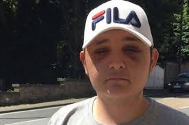 Dorian revient sur sa nuit en enfer, il y a un an: "Ils n'ont pas réussi à  me détruire à vie"