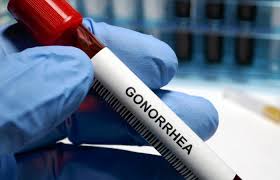 First ever gonorrhoea vaccine will be rolled out in August via sexual health services