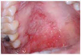 Jordi Journal Of Oral Diagnosis