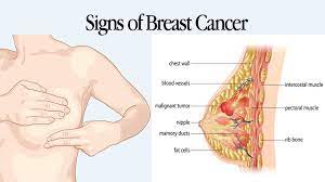Many healthy women find that their breasts. 5 Signs Of Breast Cancer Aside From A Lump Womenworking