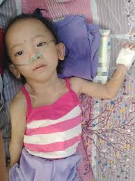 This is my daughter Mary Rose A cerebral Palsy , she's always wearing a  diaper because she cannot stand, sit and walk and always drinking milk. We  love her so much inspite