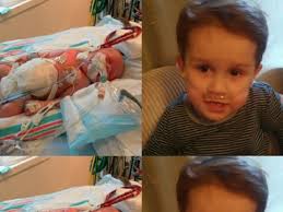 Fundraiser by Hannah von Campe : Samuel's Omphalocele Repair