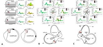Image result for Horizontal Head Impulse Test