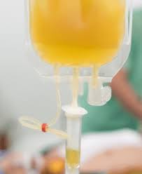 Image result for Plasma Transfusion