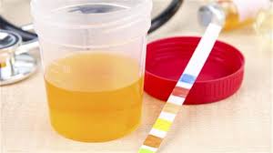 مدني رحمه الله زحف شوائب بيضاء في البول عند النساء comertinsaat com