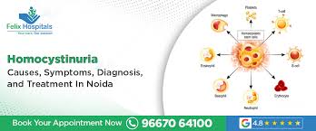 Image result for Homocystinuria