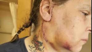 Fundraiser for Heather Anne by TracieAnn Muhammed : Heatha's Extensive  Medical Care