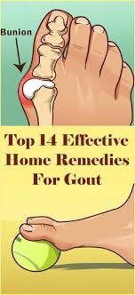 Top 14 Effective Home Remedies For Gout Living For Healthy Life Style Gout Remedies Home Remedies For Gout Home Remedies