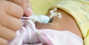 Maybe you would like to learn more about one of these? Caring For The Umbilical Cord Baby Arabia